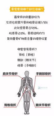 骨密度检查t值和z值是怎么得到的