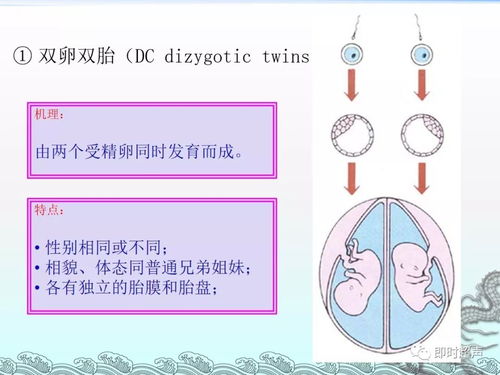 双胎及多胎妊娠综述