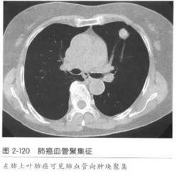 ct水是什么(水的ct值)