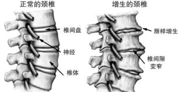 夏季 终结 颈椎病秘方 泳池做这2个动作,有效缓解脖子痛 