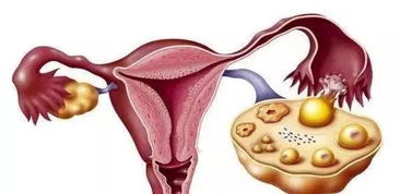 女人喝什么茶对子宫和卵巢好,女性经常什么茶保养子宫卵巢