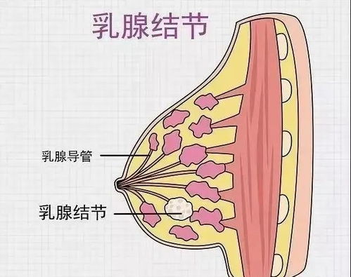 爱美的你看过来 河南省肿瘤医院乳腺结节多学科门诊开诊啦