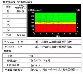 建档骨密度检测有必要吗(产检做骨密度啥意思)