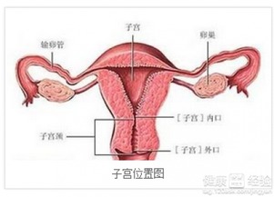 子宫囊肿切除过程