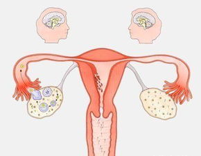 卵巢早衰闭经不孕试管治疗方案能顺利进行吗？
