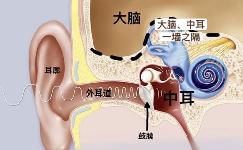 长时间佩戴耳机会引发中耳炎 小米有品推出骨传导耳机,音质不错