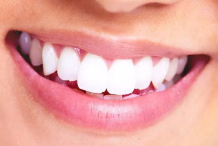 符合这 4 个标准,你的牙齿才算健康