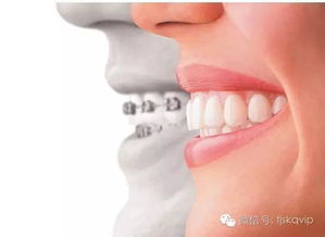 牙齿咬合异常的原因及预防方法