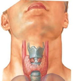 男性得甲状腺结节的原因是什么 甲状腺结节 快速问医生 