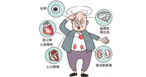 瑞合康复 高血压不动声色损害身体各器官,谁轻视,谁危险