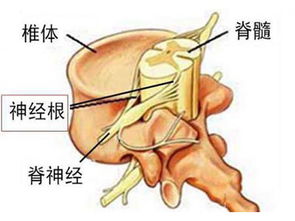 姑妈45岁了，得了宫颈癌中期，我想问一下是怎么回事？