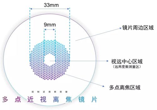 家有近视娃必看 这种框架眼镜控制近视效果很不错