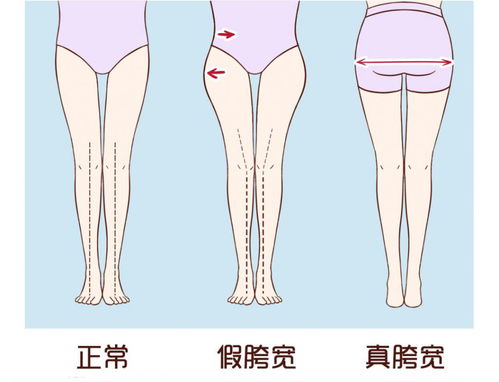 假胯宽女孩夏季怎么穿 学会 视觉错位 穿搭,这份攻略请收好