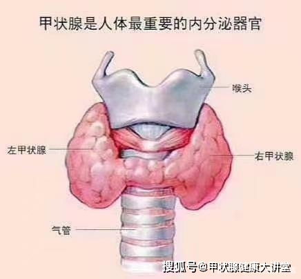 桥本氏甲状腺炎到底能不能治好 这些事情你应该了解一下