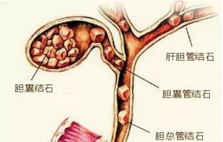 早起第一件事不是急着穿衣服 喝水 几个动作,叫醒身体