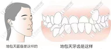 口腔资讯频道 牙科新闻资讯 开立特口腔 