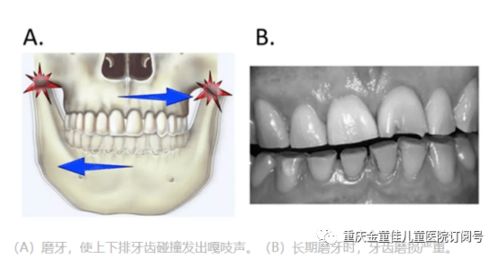 吱吱吱...... 听到这样的声音,你是不是以为孩子肚子里有蛔虫