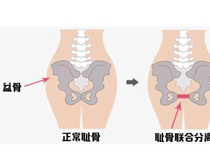 怀孕36周没有耻骨疼没有尿频有3个原因,两个注意事项别忽视