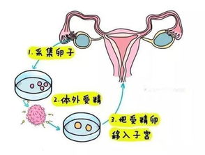 多囊试管助孕有希望怀孕吗？周期治疗过程有哪些要注意的？
