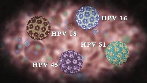 国产HPV疫苗来了 多人运动男性人群更适合接种