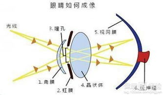 远视眼矫正有什么方法(远视的矫正方式)