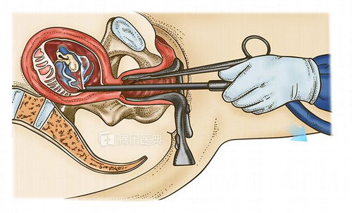 人流 只需5分钟,但胎儿经历的疼痛你远远想象不到,太扎心了