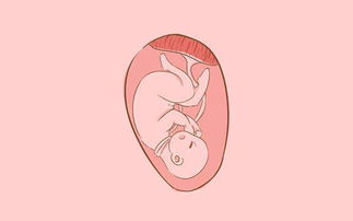 原创怀孕时，孕妇身体若有“这种”感觉，可能是出现“脐带绕颈”了