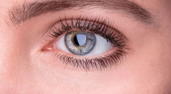 眼角周围长斑的原因是什么
