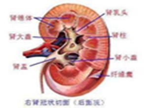 造影剂肾病，造影剂肾病简介