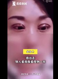 南昌一女子花6万元整容后却变更难看，整容手术到底存在哪些风险应如何避免