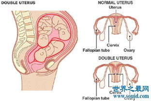 双阴是什么意思 男子公开表示与双阴道女子性爱过程 2 