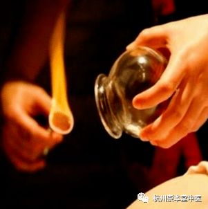 错误的拔罐方式,你中招了吗 中医师教你怎么正确拔罐