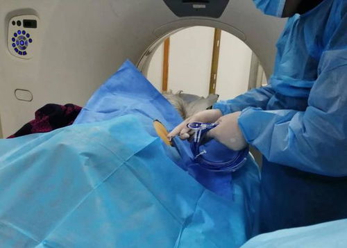 新技术丨聊城市退役军人医院成功开展CT引导下肺癌微波消融术