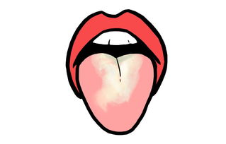 舌苔厚白 发黄 发黑是怎么回事 从舌头便能分辨体内湿气