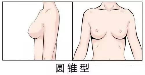 看一看你的胸型属于哪种