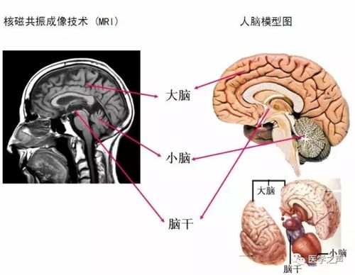 WoW,最全神经系统解剖图来了