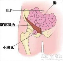 老年人疝气的值得注意的问题