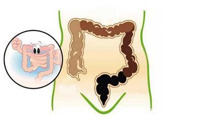 怎样排毒清肠排宿便