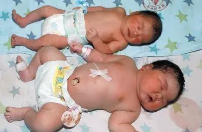 婴儿体重超11斤,出生就进监护室,宝宝出生时几斤几两最好