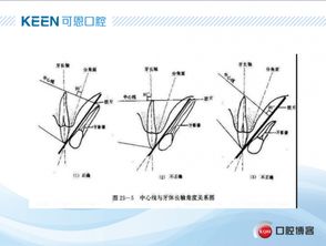 口腔小牙片拍摄技巧及注意事项