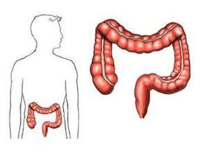 结肠癌患者饮食上需注重摄入膳食纤维 