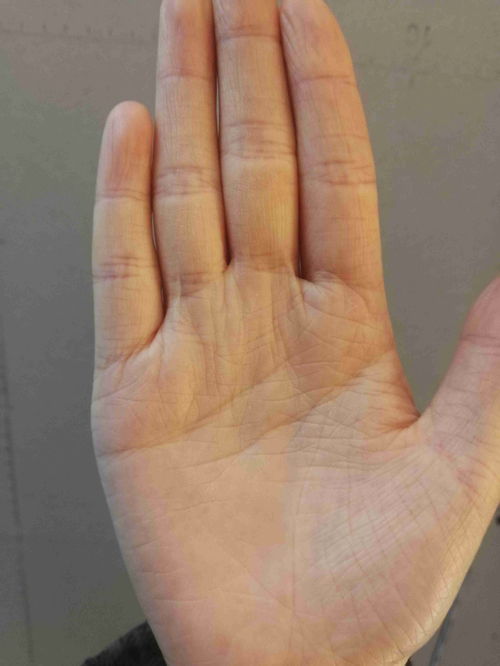 三角在太阳线上手纹,怎么看手相手相的三条线分别代表什么