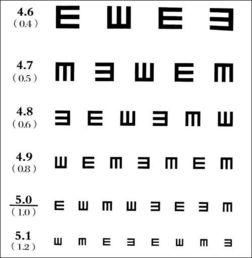 矫正视力1.0相当于正常多少度,和1.5有什么区别,那5.0 5.2又代表什么样的视力 