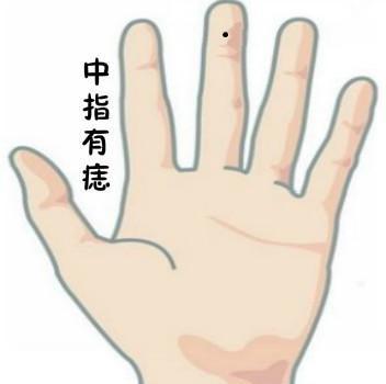 五根手指的桃花痣各代表什么