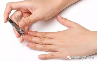 手指甲 脚趾甲剪得越短越干净 小心发生嵌甲