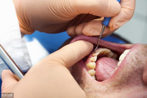 牙齿怎么好像变 长 了 这是牙龈萎缩 专家告诉怎么应对及预防
