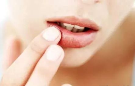 1个月嘴唇变薄的方法,五个方法告别香肠嘴