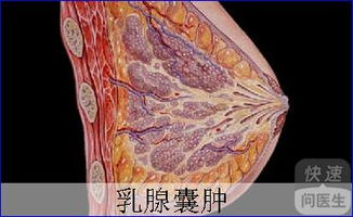 乳腺囊肿的症状有哪些 乳腺囊肿的三种症状