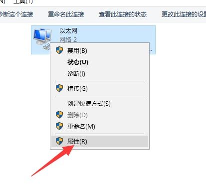 笔记本win10以太网显示网络电缆被拔出