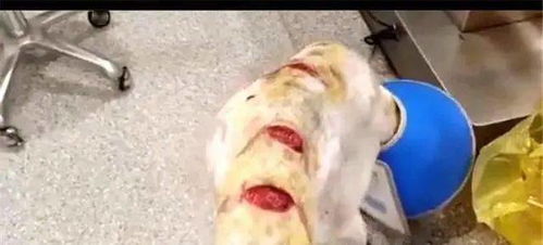 贵州丨太残忍 1岁小狗狗全身刀伤,皮开肉绽,满身血,小狗疼的颤抖不止 受伤 